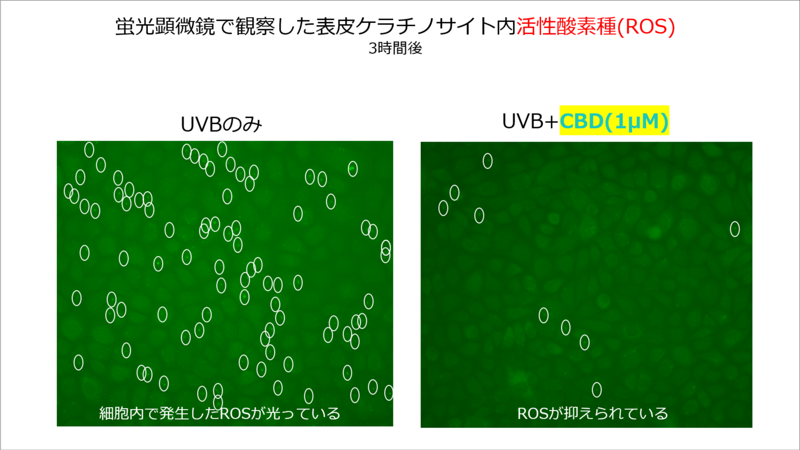 CBDによる皮膚の老化防止効果